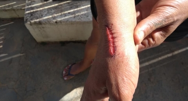 Após separação mulher é agredida e esfaqueada pelo ex-marido em Carmo do Paranaíba Após separação mulher é agredida e esfaqueada pelo ex-marido em Carmo do Paranaíba