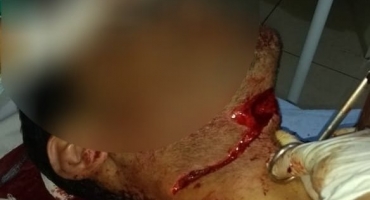 Homem sobrevive a corte profundo no pescoço durante tentativa de homicídio Homem sobrevive a corte profundo no pescoço durante tentativa de homicídio