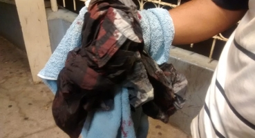 Por causa de garrafa de cerveja homem é atingido com golpe de enxada no município de Patos de Minas Por causa de garrafa de cerveja homem é atingido com golpe de enxada no município de Patos de Minas