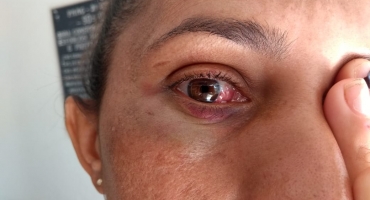 Briga em Carmo do Paranaíba termina com mulher de 35 anos ferida