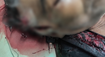 Garimpeiro é socorrido em estado grave após ser atingido por golpes de facão no município de Carmo do Paranaíba Garimpeiro é socorrido em estado grave após ser atingido por golpes de facão no município de Carmo do Paranaíba