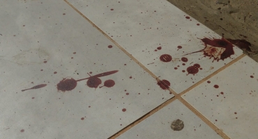 Homem é baleado no rosto quando deixava boate na cidade de Patos de Minas Homem é baleado no rosto quando deixava boate na cidade de Patos de Minas
