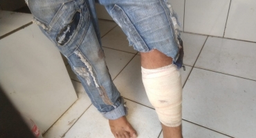 Homem tenta cometer assalto em casa de mãe de policial e leva tiro na perna em Patos de Minas Homem tenta cometer assalto em casa de mãe de policial e leva tiro na perna em Patos de Minas