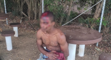 Indivíduos que usavam drogas em dependência de escola brigam e homem fica gravemente ferido Indivíduos que usavam drogas em dependência de escola brigam e homem fica gravemente ferido