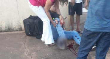 Acidente deixa motociclista sem ponta de dedo e fratura exposta em Patos de Minas Acidente deixa motociclista sem ponta de dedo e fratura exposta em Patos de Minas