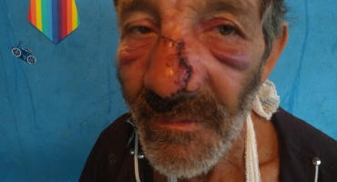 Homem sofre graves ferimentos ao ser atingido com barra de ferro por desafeto em Carmo do Paranaíba