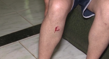 Leiturista é atacado por cães pitbull, no Bairro Jardim Panorâmico em Patos de Minas Leiturista é atacado por cães pitbull, no Bairro Jardim Panorâmico em Patos de Minas