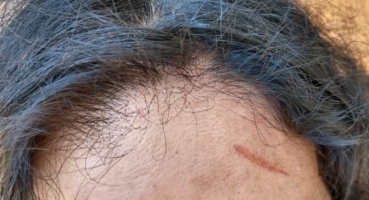 Briga em casa de forró termina com homem esfaqueado e três mulheres detidas
