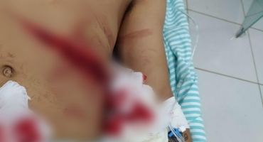 Seis pessoas ficam feridas após serem atingidas por golpes de canivete no Distrito de Monjolinho