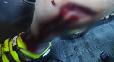 Ciclista é atacado por cães em Patos de Minas e sofre ferimentos graves