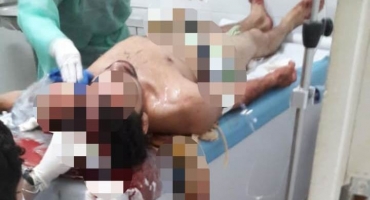 Carmo do Paranaíba: rapaz de 24 anos é atingido na cabeça por golpe de faca desferido por mulher Carmo do Paranaíba: rapaz de 24 anos é atingido na cabeça por golpe de faca desferido por mulher