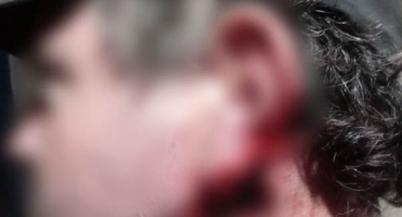 Homem tem parte da orelha dilacerada após briga por acerto de drogas em Lagamar Homem tem parte da orelha dilacerada após briga por acerto de drogas em Lagamar