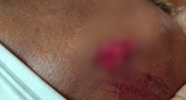 Homem é agredido e roubado no Bairro Cristo Redentor em Patos de Minas Homem é agredido e roubado no Bairro Cristo Redentor em Patos de Minas