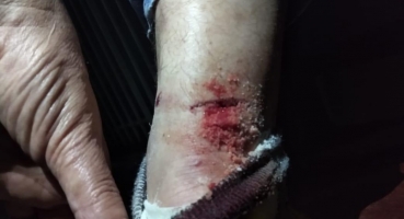 Cachorro ataca mulher no bairro Vila Garcia em Patos de Minas Cachorro ataca mulher no bairro Vila Garcia em Patos de Minas