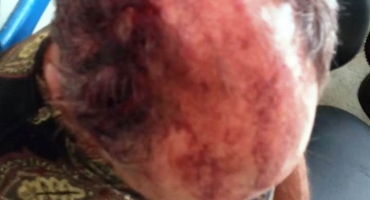 Durante bebedeira homem atinge colega com cadeirada na cabeça em Carmo do Paranaíba 