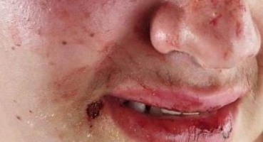 Filho de 12 anos apanha do pai por causa de brinco em Patos de Minas Filho de 12 anos apanha do pai por causa de brinco em Patos de Minas