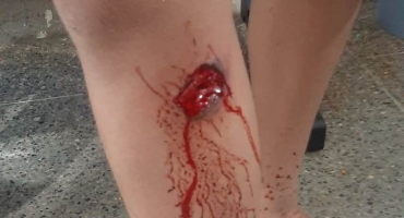 Polícia Militar de Presidente Olegário teria usado balas de borracha durante confusão em evento de páscoa Polícia Militar de Presidente Olegário teria usado balas de borracha durante confusão em evento de páscoa