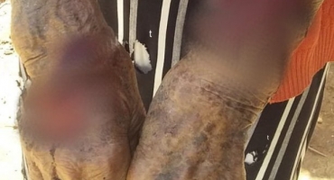 Crueldade: idosa de 90 anos fica ferida após ser amarrada por ladrão durante roubo na comunidade do Aragão Crueldade: idosa de 90 anos fica ferida após ser amarrada por ladrão durante roubo na comunidade do Aragão