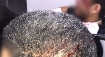 Motorista de aplicativo e passageiro são agredidos por assaltante em Patos de Minas; um deles chegou a ser sequestrado e obrigado a pular de motocicleta em movimento Motorista de aplicativo e passageiro são agredidos por assaltante em Patos de Minas; um deles chegou a ser sequestrado e obrigado a pular de motocicleta em movimento
