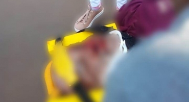 Ciclista fica gravemente ferido após sofrer queda em estrada vicinal em Lagoa Formosa Ciclista fica gravemente ferido após sofrer queda em estrada vicinal em Lagoa Formosa