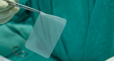 Implantes de telas em cirurgias de hérnias abdominais reduzem risco de retorno da doença em até 80% Implantes de telas em cirurgias de hérnias abdominais reduzem risco de retorno da doença em até 80%