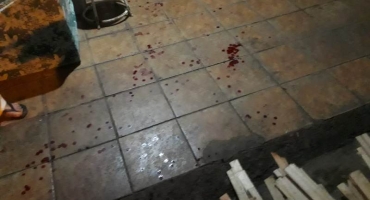 Homem de 44 anos é atingido por golpes de facão no bairro Cristo Redentor em Patos de Minas Homem de 44 anos é atingido por golpes de facão no bairro Cristo Redentor em Patos de Minas