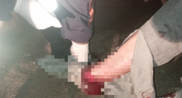 Carmo do Paranaíba - Homem pula do 2º andar de residência para fugir do ex da companheira, sofre fratura exposta e ainda é espancado pelo agressor Carmo do Paranaíba - Homem pula do 2º andar de residência para fugir do ex da companheira, sofre fratura exposta e ainda é espancado pelo agressor