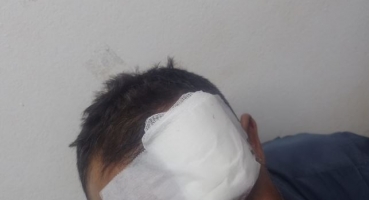 Por ciúmes mulher atinge namorado com golpe de garrafa na cabeça na cidade de Patos de Minas Por ciúmes mulher atinge namorado com golpe de garrafa na cabeça na cidade de Patos de Minas