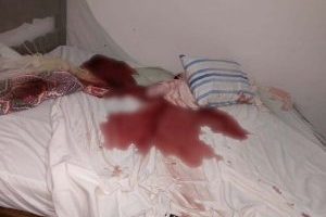 Após 18 dias internado morre idoso baleado por assaltantes em Presidente Olegário Após 18 dias internado morre idoso baleado por assaltantes em Presidente Olegário