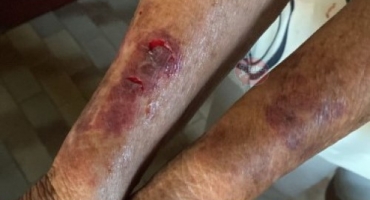 Patos de Minas - Homem é preso após agredir a própria mãe de 79 anos e causar danos à residência Patos de Minas - Homem é preso após agredir a própria mãe de 79 anos e causar danos à residência