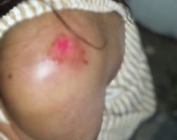 Mulher é agredida pelo companheiro em Patos de Minas; após recusar fazer sexo dentro de carro Mulher é agredida pelo companheiro em Patos de Minas; após recusar fazer sexo dentro de carro