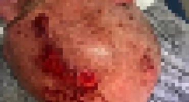 Homem embriagado é brutalmente agredido após urinar em via pública na cidade de Patos de Minas Homem embriagado é brutalmente agredido após urinar em via pública na cidade de Patos de Minas