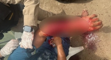 Mulher é presa por esfaquear ex-companheiro após encontrá-lo com outra mulher na casa dele; em Patrocínio