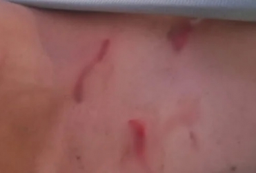 Jovem é preso por tentativa de homicídio após ataque com tesoura em barbearia na cidade de Patos de Minas